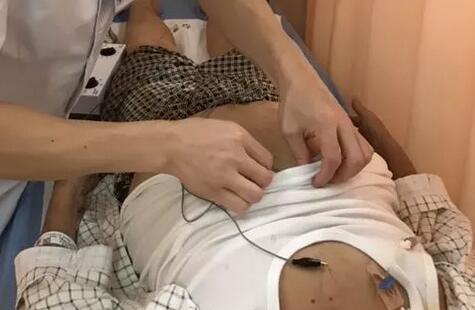 術後打嗝不止？快試試中醫針灸